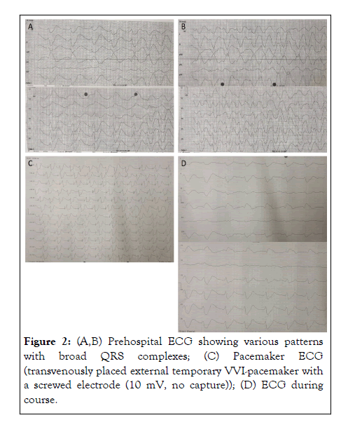 Clinical-QRS