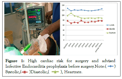 Cardiac