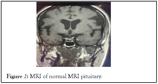 MRI