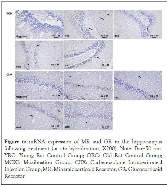 mRNA