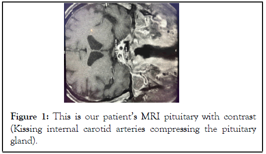 pituitary