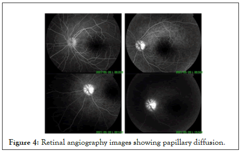 Angiography