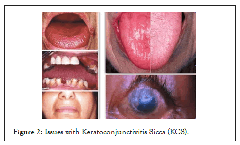 Experimental-Ophthalmology-Keratoconjunctivitis