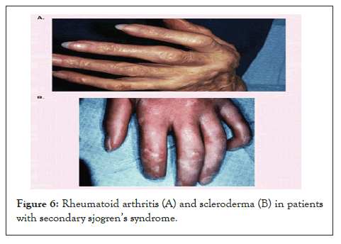 Experimental-Ophthalmology-Rheumatoid