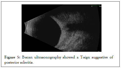 Ultrasonography