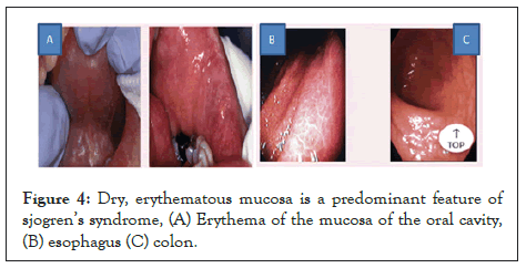 Experimental-Ophthalmology-erythematous