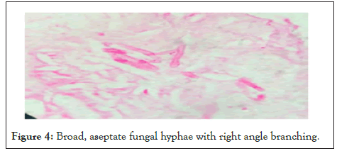 hyphae