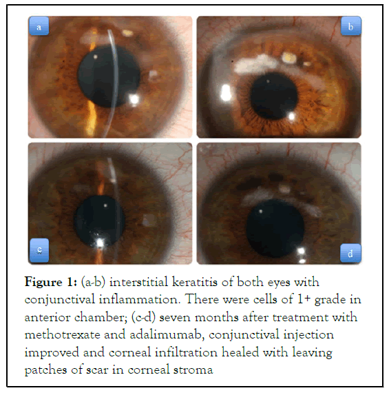 Experimental-Ophthalmology-keratitis