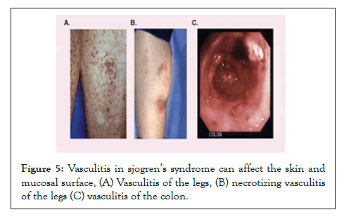 Experimental-Ophthalmology-mucosal