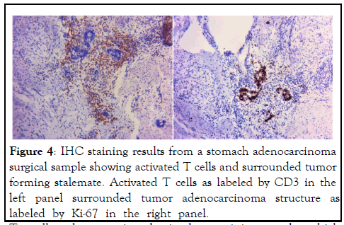 IMR-adenocarcinoma