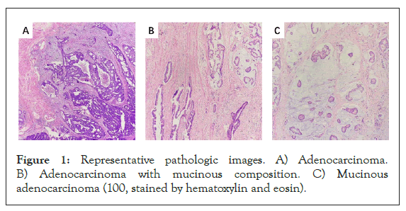 Immunogenetics-pathologic