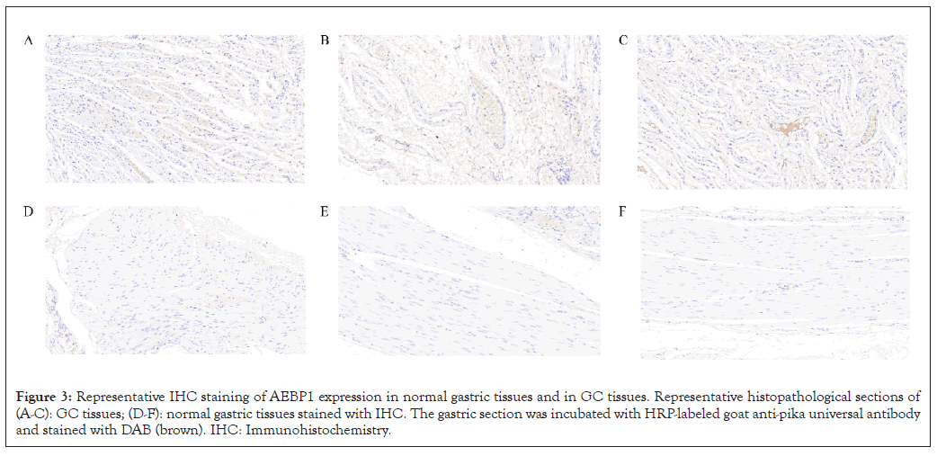 Immunotherapy-gastric