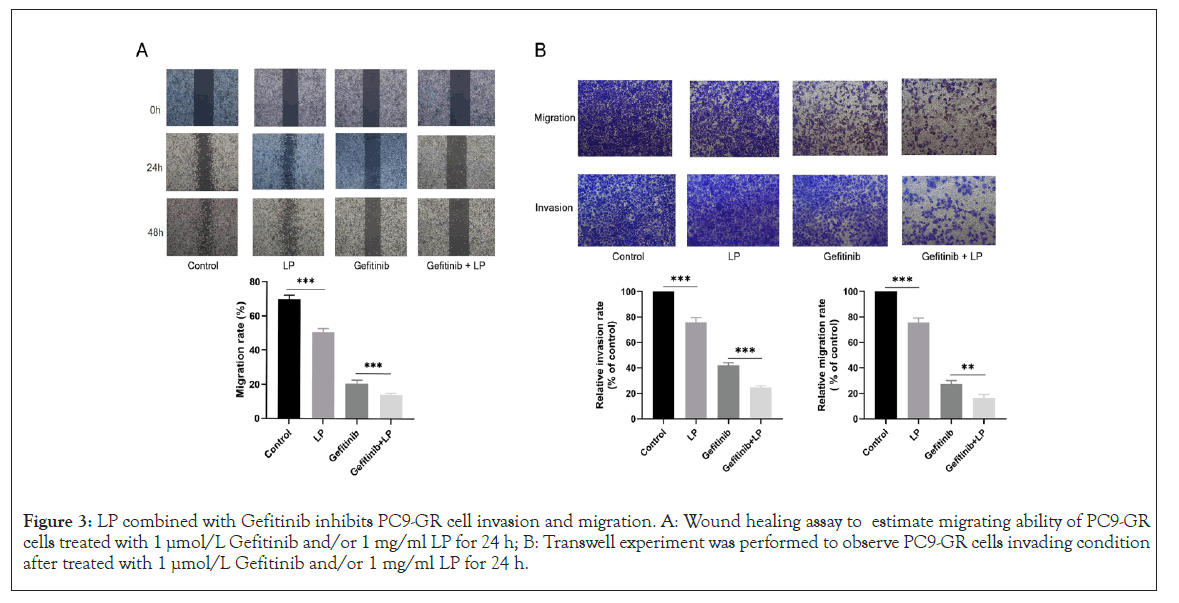 Immunotherapy-migration