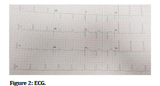 JRMDS-ECG