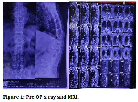 JRMDS-and