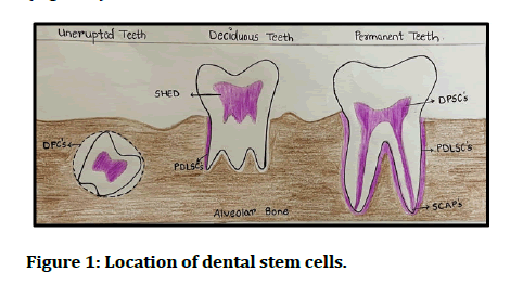 JRMDS-dental