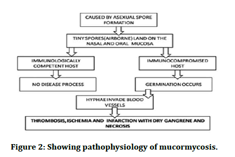 JRMDS-pathophysiology