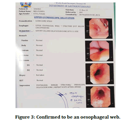 Jrmds-oesophageal