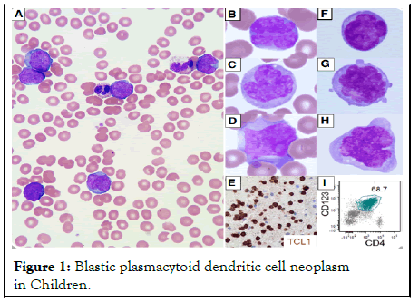 Leukemia-dendritic