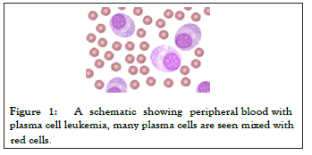 Leukemia-many