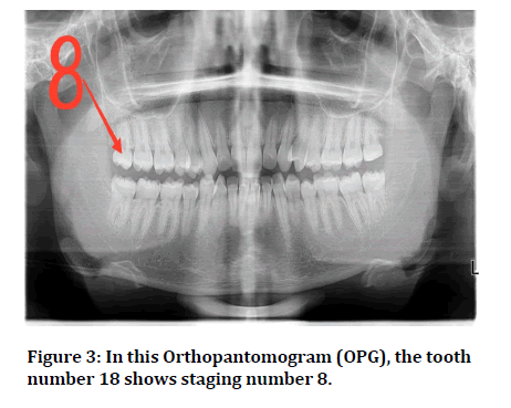 Medical-Dental-Orthopantomogram