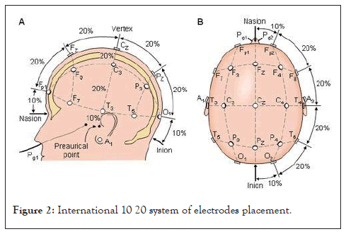 electrodes