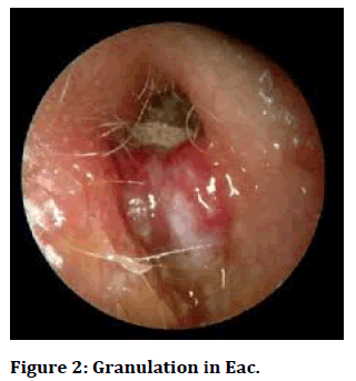 Medical-Granulation