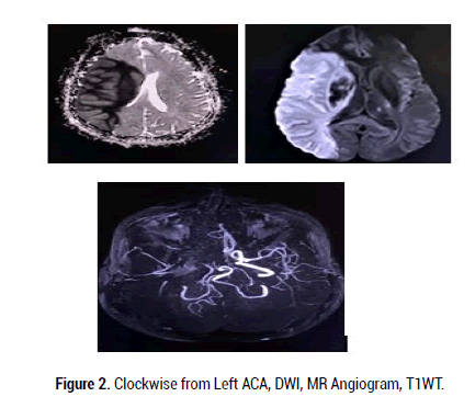 Medical-Reports-Angiogram