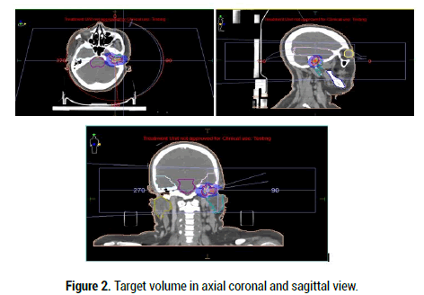 Medical-Reports-coronal