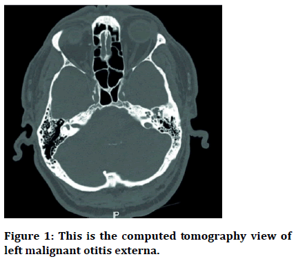 Medical-computed Medical-computed
