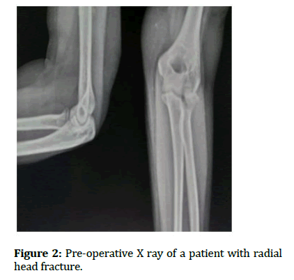 Medical-patient