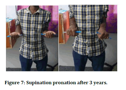 Medical-pronation