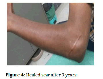 Medical-scar