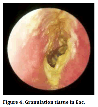 Medical-tissue