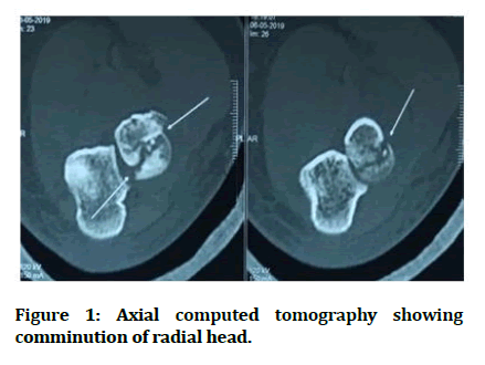 Medical-tomography