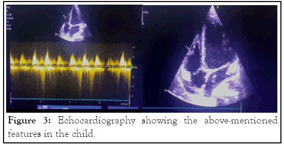 Echocardiography