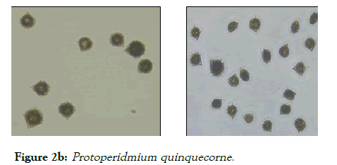 OCN-Protoperidmium