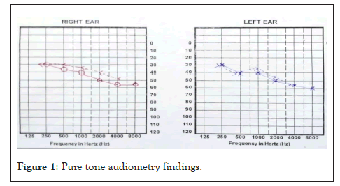 audiometry