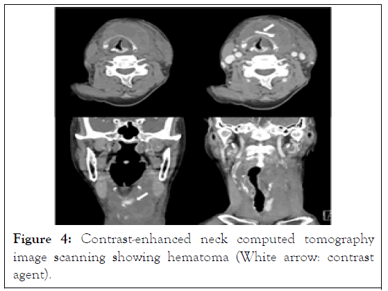 tomography