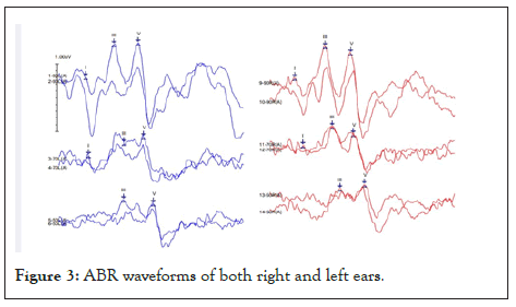 waveforms