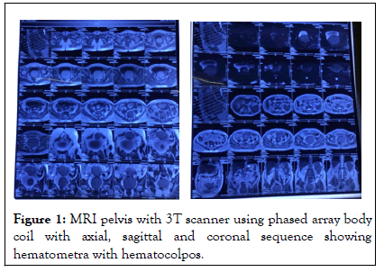 Reproductive-System-scanner