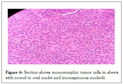 nuclei