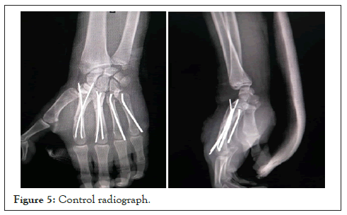 radiograph