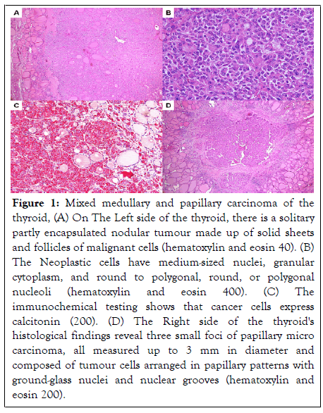 Thyroid-Disorders-nuclear