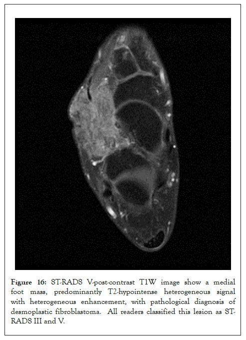 fibroblastoma