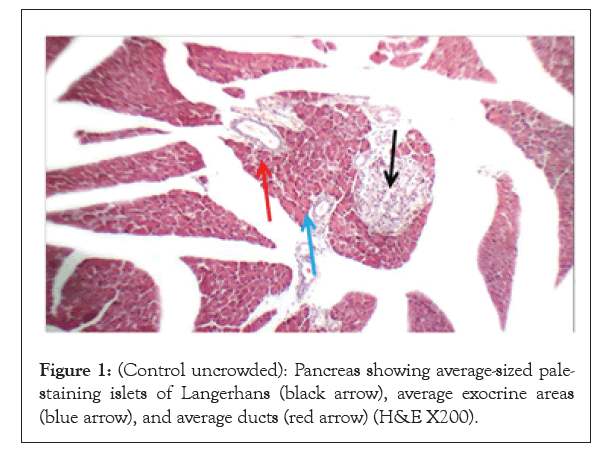 anatomy-physiology-pancreas