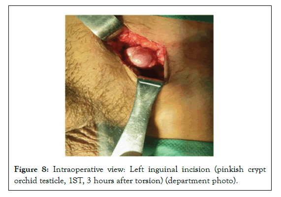 andrology-Intraoperative