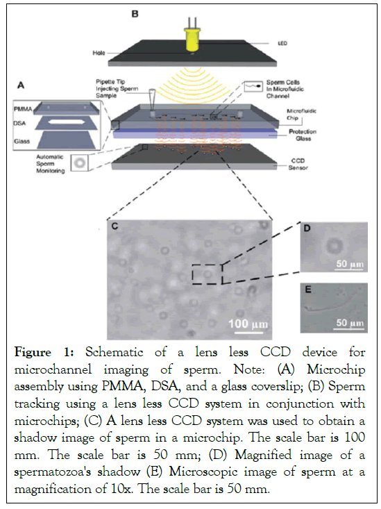 andrology-lens