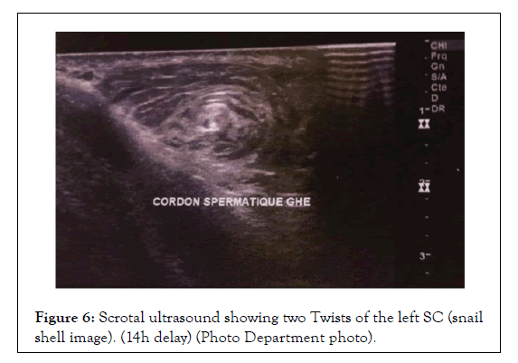 andrology-ultrasound