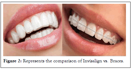 annals-essences-comparison